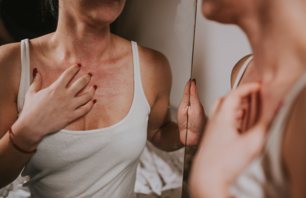 Sí, las alergias primaverales pueden afectarte más allá de un par de estornudos: esto es lo que hacen en tu piel